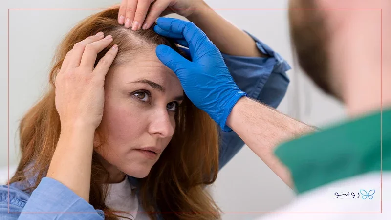 تجربه واقعی بیماران در مورد ریزش مو بعد از عمل بینی