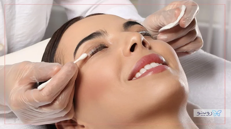 هزینه لیفت کردن مژه ها با بهترین کیفیت