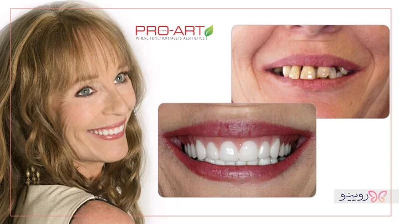 برند پروآرت (ProArt)