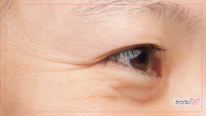 علائم اولیه پیری