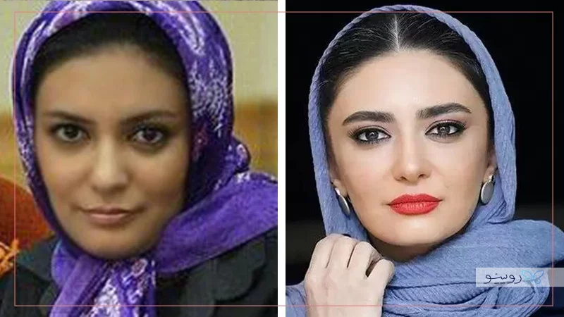 لیندا کیانی