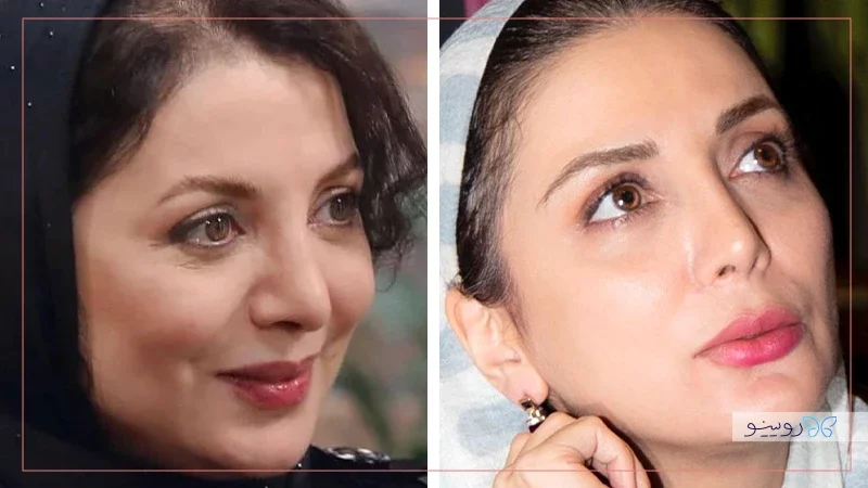 رویا میرعلمی
