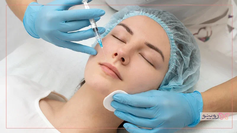 برای خط خنده ژل بهتر است یا چربی؟