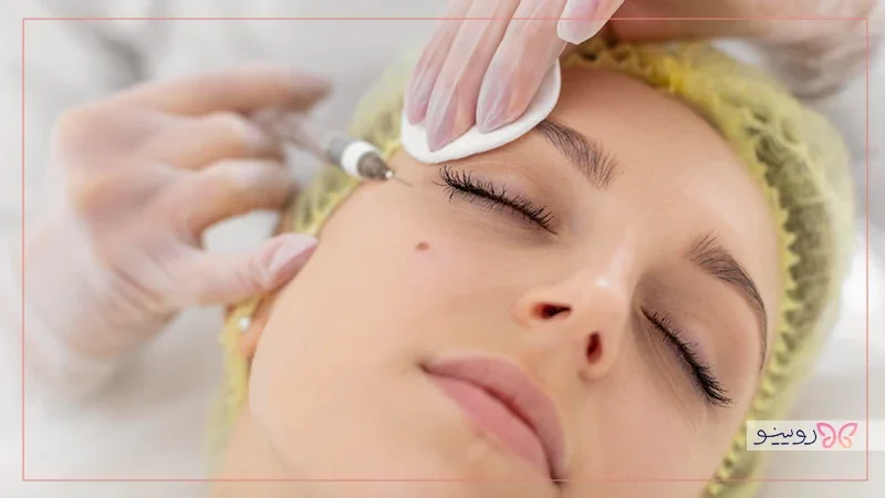فیلر و ژل کدام طبیعی و کدام مصنوعی است؟