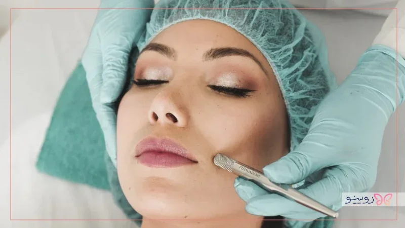 ماندگاری مزوتراپی در مقایسه با روش های دیگر 