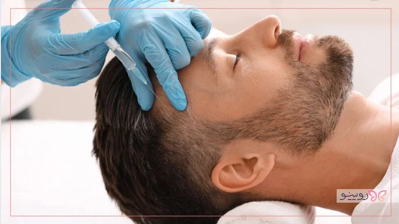 شناخت بهترین برند مزوتراپی مو 