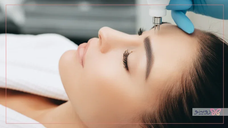 مقایسه قیمت برندهای مختلف مزوتراپی صورت در بازار