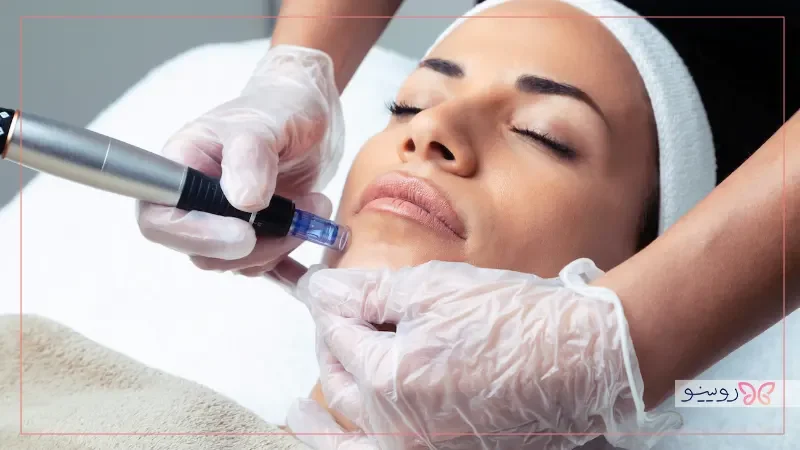 تفاوت مزونیدلینگ و میکرونیدلینگ