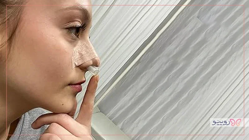 نوزونت دماغ برای چه کسانی مناسب است و چه زمانی باید استفاده شود؟