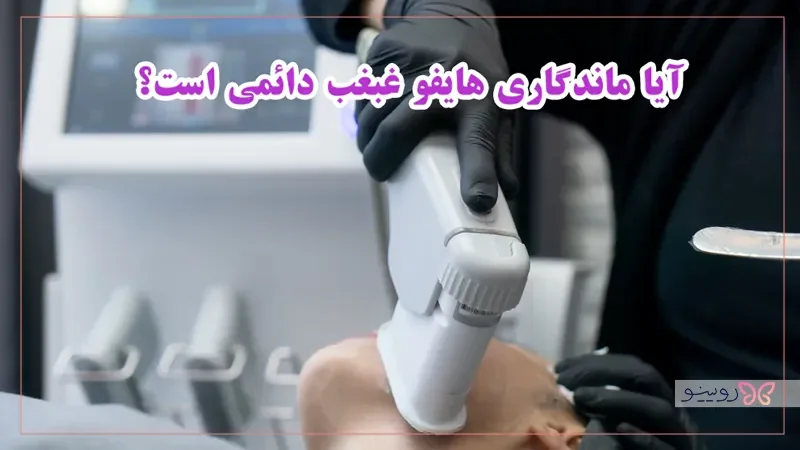 آیا ماندگاری هایفو غبغب دائمی است؟