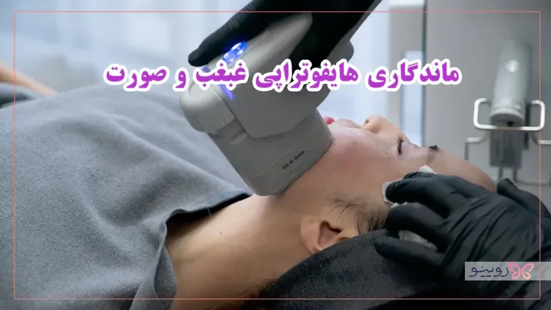 ماندگاری هایفوتراپی غبغب و صورت