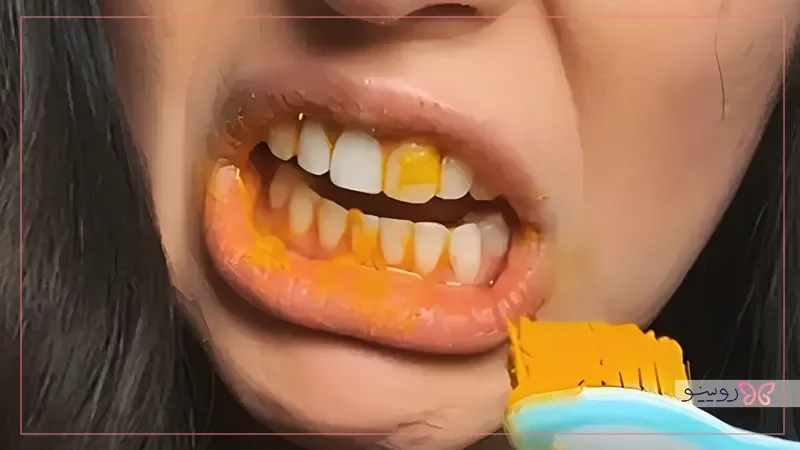 زردچوبه و نمک برای کاهش درد دندان