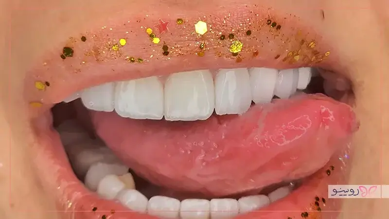 نگهداری و مراقبت از لمینت و روکش