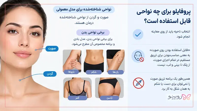 نواحی قابل استفاده پروفایلو در صورت، گردن و برخی نواحی بدن