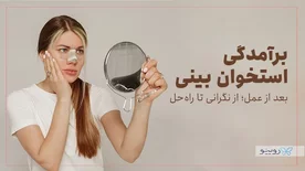 برآمدگی استخوان بینی بعد از عمل؛ از نگرانی تا راه‌حل