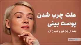 علت چرب شدن پوست بینی بعد از عمل و درمان آن