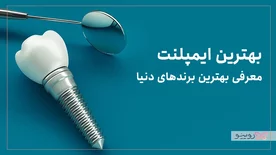 بهترین ایمپلنت مال کدام کشور است؟