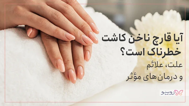 آیا قارچ ناخن کاشت شده خطرناک است؟ بهترین روش‌ها برای درمان قارچ ناخن