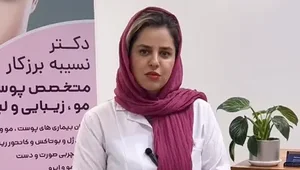 ریزش مو