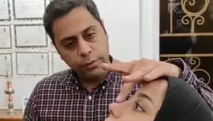 عمل بینی با اسپیلنت خارجی