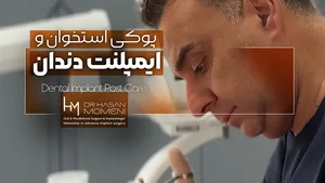 کاشت ایمپلنت برای بیماران دارای پوکی استخوان